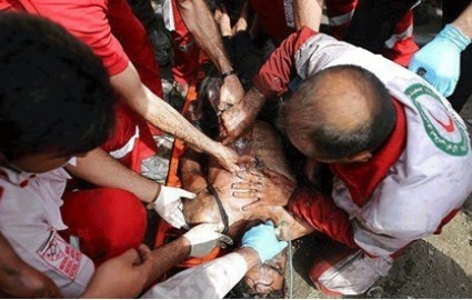 سقوط تخته سنگ ۳ تنی بر روی اندام تحتانی یک مرد در معدن سنگ اصفهان